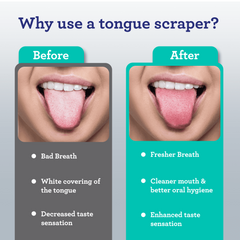 GuruNanda Stainless Steel Tongue Scraper